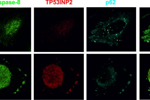 Diferents localitzacions de les proteïnes involucrades en apoptosi en condicions basals (Ctrl) i amb inducció dels receptors de mort cel·lular amb TRAIL. Saška Ivanova, IRB Barcelona