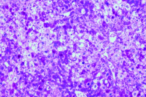 Sample from mouse liver. A high glycogen content (pink) suppresses appetite and improves the management of diabetes and obesity. Image: I López-Soldado, IRB Barcelona