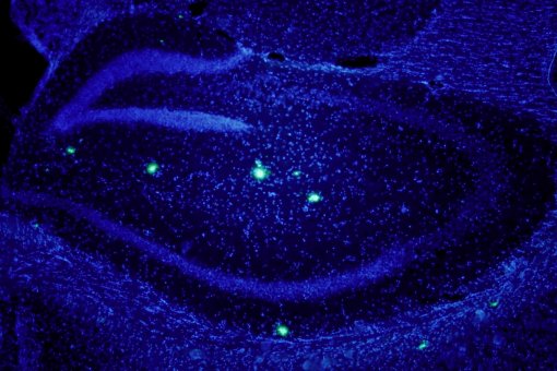 Beta amyloid protein and AD are strongly linked but the role of this protein in this disease remains elusive. Hippocampus of transgenic mice overexpressing amyloid beta. In blue, neuronal nuclei. In green, beta amyloid plaques (E.Verdaguer/S.Brox)