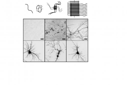 Representative images of beta-amyloid aggregation and the dendritic trees of living and dead neurons (Bernat Serra-Vidal, IRB Barcelona/Lluís Pujades & Daniela Rossi UB)