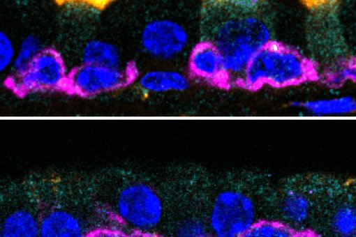 GEMC1 és necessari per generar cèl·lules multiciliades. Imatges de les tràquees de ratolins. Els cilis (en groc) són notoris en els models amb el gen GEMC1 (a dalt), mentre que els ratolins que no el tenen, no se'n generen. (Berta Terré, IRB Barcelona)