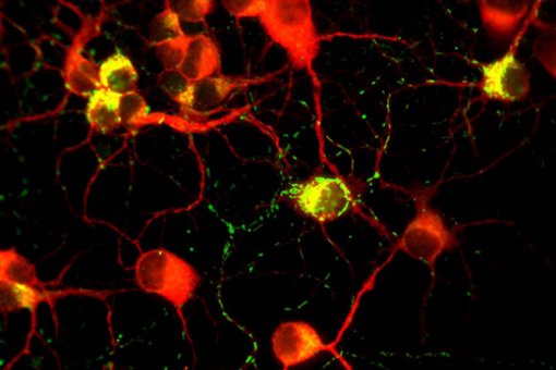 Neurones de ratolí amb el gen de la Frataxina transferit. En groc, localització de la proteína frataxina a les neurones (Imatge: Laboratori de Díaz-Nido)