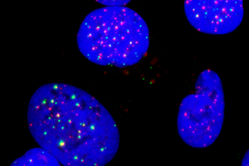 Células cancerosas con inhibición de la TLK muestran intermediarios de replicación (verde) en los extremos de los cromosomas (rojo) - (IRB Barcelona).