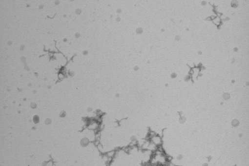 Natàlia Carulla's team studies the associations of beta-amyloid. In the microscopy image, beta-amyloid clusters are observed in in vitro samples. (Bernat Serra-Vidal, IRB Barcelona)