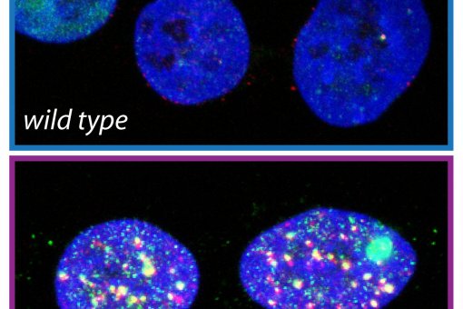 La inhibición de TLK conduce al estrés replicativo (verde) y a daño extensivo en el ADN (rojo) en células cancerosas cultivadas. Sandra Segura-Bayona, IRB Barcelona.