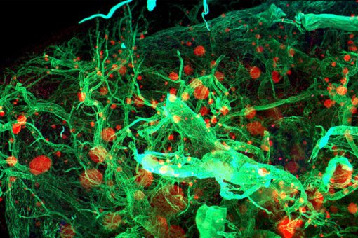 "Un pàncrees de ratolí fotografiat amb pla selectiu d'il·luminació microscòpica, una tècnica que s'utilitzarà". Imatge: Ahlgren, Mayer & Swoger/CRG. 