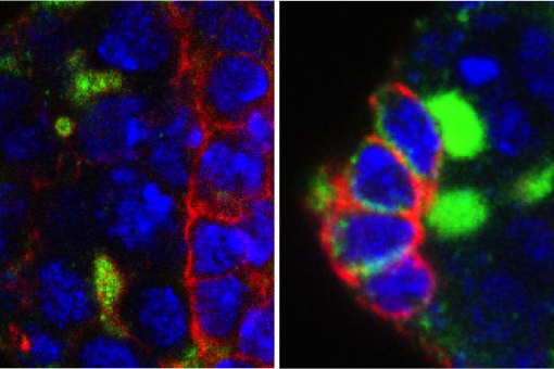  Microscòpia de les cèl·lules mare germinals (verd brillant) de l'ovari de Drosophila de les mosques que no tenen EXD2. Les mosques al panell dret van ser tractats amb antioxidants per rescatar les cèl·lules mare. Imatg: Travis Stracker, IRB Barcelona 