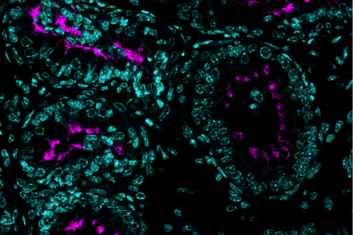 Corte transversal de conductos eferentes sanos fotografiada con un microscopio fluorescente