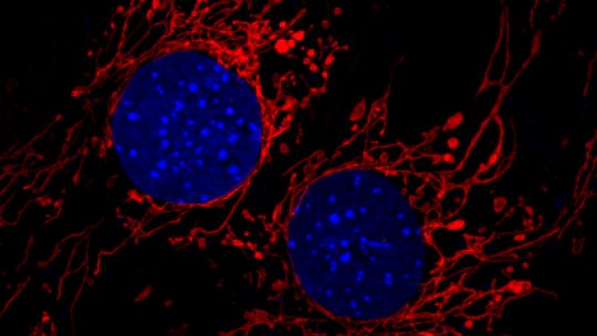 Cèl·lules amb la xarxa mitocondrial marcada en vermell. Imatge: David Sebastián, IRB Barcelona