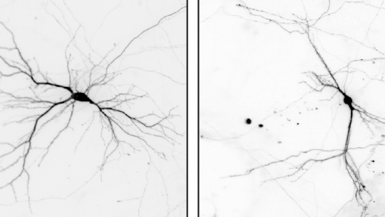 Les imatges mostren neurones preparades a partir de cervells de ratolins de control (esquerra) i ratolins sense el gen Nek7. Les dendrites són més curtes i estan menys ramificades a les neurones de ratolins sense NEK7.