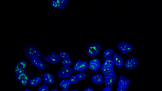 Nuclis de cèl·lules metastàtiques de càncer de mama amb la proteïna MSK1 en verd (Autor: Cristina Figueras-Puig, IRB Barcelona)