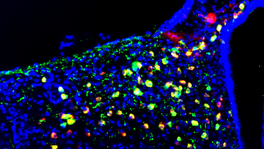 Imatge de microscopia de fluorescència del nucli arcuat de l'hipotàlem on s'aprecien, en color verd, les neurones POMC (Imatge: Alicia G Gómez-Valadés).