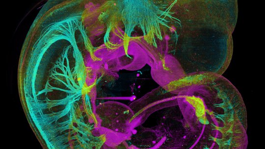 En este embrión de ratón, se observan estructuras de contienen neurofilamentos, en cian, y la proteína E-Caderina, en magenta, que muestran respectivamente el sistema nervioso y los órganos internos (Autores: S. Swoger, J. Mayer, L. Quintana. CRG 2017)