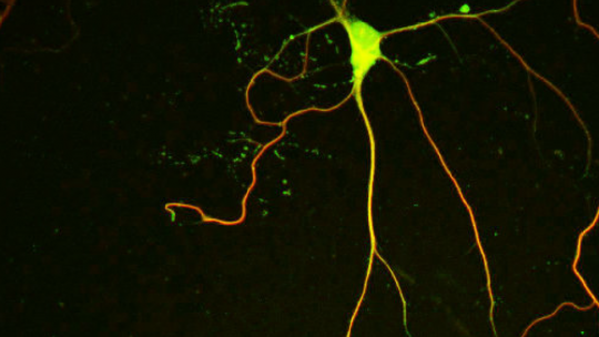 The picture shows a cultured neuron stained with antibodies that label microtubules. NEK7 promotes the stability of the dendritic microtubules, which is important for proper dendrite growth and branching (F Freixo, IRB Barcelona)