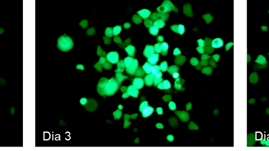 The image shows tumour cells infected by the virus, which expresses a fluorescent protein. Over the days, the virus multiplies, generating new virions that infect more cancer cells. (IDIBAPS, IRB Barcelona)