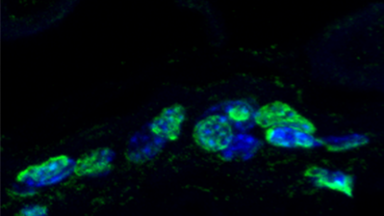 DNA damage accumulation (in green) in old mice skin (Guiomar Solanas and Francisca Peixoto, IRB Barcelona)