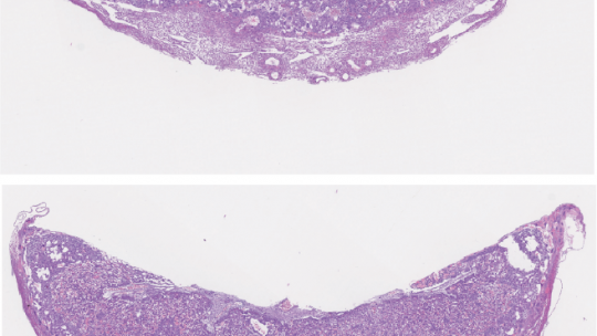 Cross sections of H&E stained wild type or TLK2 deficient placentas at embryonic day 12.5. Placental development is defective in the absence of TLK2 (above). (S. Segura-Bayona, IRB Barcelona)