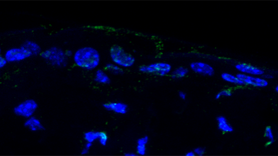 Células madre de la piel de ratones jóvenes. No se observa daño en el ADN (Guiomar Solanas y Francisca Peixoto, IRB Barcelona)